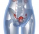 Ar tikrai prostatos vėžio vyrai patys nepastebi? 